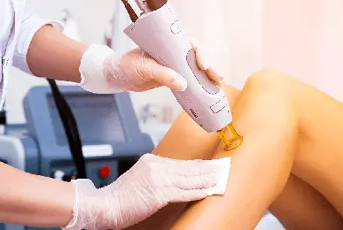laser-hair-removal