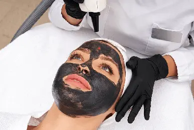 melasma