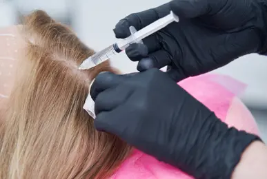 prp-treatment